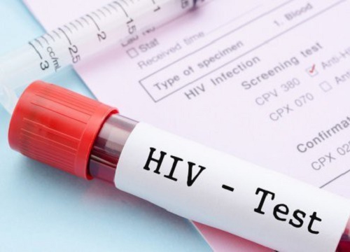 Lần đầu tiên các nhà khoa học loại bỏ được HIV trong toàn bộ gen của chuột: Đem lại hi vọng loại bỏ HIV ở người