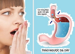 Dấu hiệu trào ngược dạ dày bạn nên biết