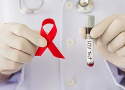 23,3 triệu người nhiễm HIV toàn cầu được điều trị bằng ARV