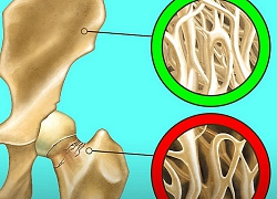 Uống sữa nghệ trước khi đi ngủ: Không chỉ giúp da trắng hồng như gái 20 lại còn chống được ung thư và giảm béo