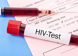 Gần 66% số ca nhiễm HIV do nguyên nhân này