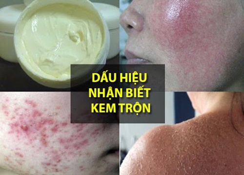 Kem trộn là gì? Những tác hại và cách nhận biết kem trộn trắng da