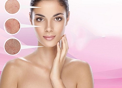 Tại sao tất cả beauty spa đều trang bị máy phân tích da?