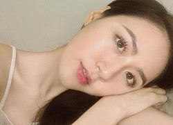 Beauty blogger vẫn khủng hoảng mụn như thường, và đó là lúc Mai Vân Trang tìm ra 3 "bảo bối" cứu da tuyệt đỉnh này!