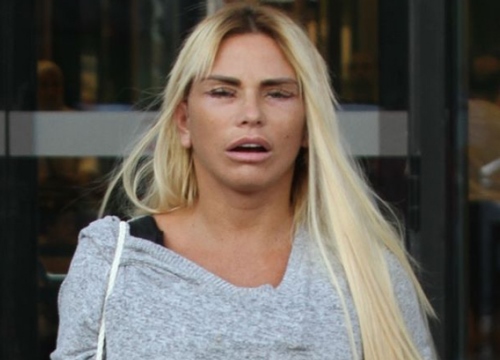 Katie Price bị biến chứng sau phẫu thuật thẩm mỹ