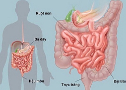 Người mệt mỏi, gầy yếu, sút cân không ngờ mắc ung thư ruột non hiếm gặp