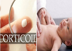 Trẻ có thể bị ngộ độc toàn thân nếu dùng thuốc bôi ngoài da có thành phần corticoid