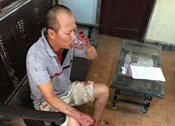 Anh vác dao thảm sát gia đình em ruột: Thêm 2 nạn nhân qua đời