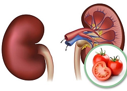 Những người không nên ăn cà chua