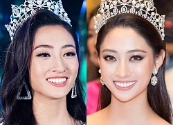 Rộ tin đồn hoa hậu Lương Thùy Linh làm lại răng sau 1 tháng đăng quang Miss World Vietnam