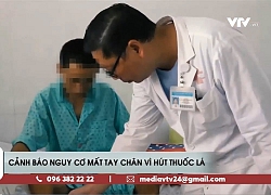 Cảnh báo nguy cơ mất tay, chân vì hút thuốc lá