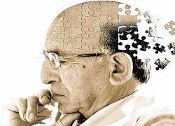 Chúng ta có hiểu sai về căn bệnh Alzheimer?