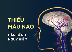 Nên dùng thuốc gì khi thiếu máu não?