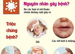 Chuyên gia chỉ cách nhận diện bệnh tay chân miệng ở trẻ em qua các giai đoạn