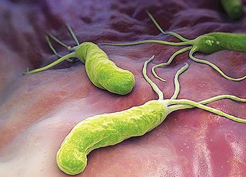 Cơn ám ảnh "H. Pylori gây ung thư dạ dày"