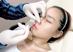 Tự ý mua filler qua mạng để nâng mũi cao đẹp, cô gái không ngờ phải nhận cái kết đắng chát vì mũi mới bị hoại tử, đầy mủ