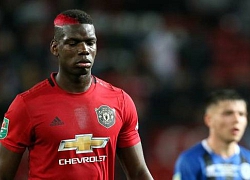 Paul Pogba nhiều khả năng bỏ lỡ trận gặp Arsenal