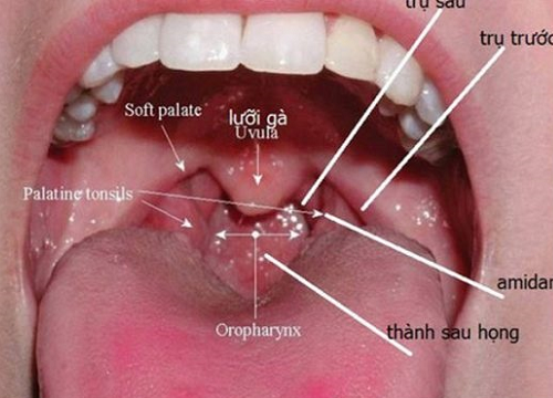 Ung thư vòm họng là gì?