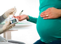 Hành tây và những công dụng bất ngờ mẹ bầu không nên bỏ qua
