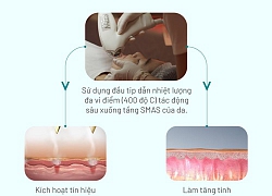 Mezo - công nghệ triệu đô trong điều trị rỗ, nám