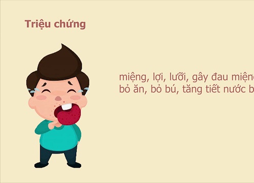 Mách mẹ cách bảo vệ bé yêu trước dịch chân tay miệng đang bùng phát