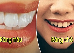 Xem tướng răng biết ngay vận mệnh sang- hèn: Số đại gia hay nghèo mạt vận đều hiện rõ