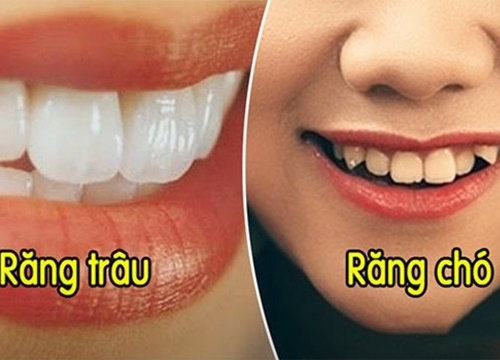 Xem tướng răng biết ngay vận mệnh sang- hèn: Số đại gia hay nghèo mạt vận đều hiện rõ