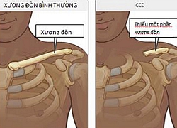 Trẻ bị chứng bệnh cực hiếm, 1 triệu ca sinh mới có 1 trường hợp mắc