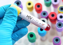 Phát hiện ra chủng HIV mới lần đầu tiên sau 19 năm