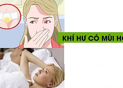 Khí hư có mùi hôi: Tất tần tật những điều nên biết