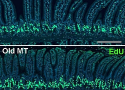 Vi khuẩn trong ruột có thể làm thay đổi quá trình lão hóa