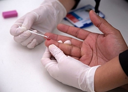 Mỗi ngày có hơn 300 trẻ em và trẻ vị thành niên chết vì AIDS