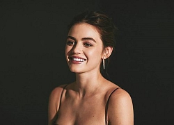 Lucy Hale tiết lộ chu trình cải thiện da mụn do nội tiết