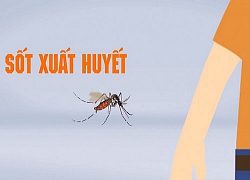 Đối phó dịch sốt xuất huyết