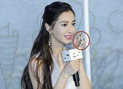 Angelababy phải đeo nẹp ngón tay sau tai nạn quay show