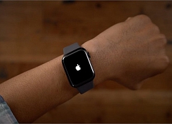 Hướng dẫn vô hiệu hóa screenshot trên Apple Watch