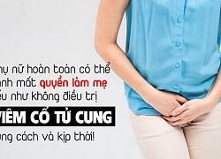 Điều trị viêm cổ tử cung hiệu quả với 4 cách đơn giản