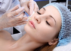 Nhiều người gặp biến chứng do tiêm filler trẻ hóa khuôn mặt, chuyên gia đưa ra khuyến cáo cực quan trọng mà ai cũng cần biết