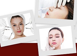 Khi filler bị lạm dụng tràn lan