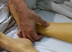 9 dấu hiệu ai cũng nghĩ chỉ là "bệnh vặt" mà không ngờ đó có thể là biểu hiện của bệnh ung thư tuyến tụy nguy hiểm