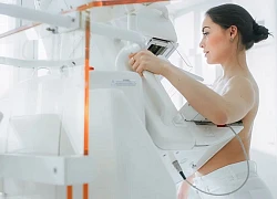 "Chiến thắng" 6 bác sĩ, trí tuệ nhân tạo xác định ung thư vú chính xác, mở ra cơ hội sống cho hàng ngàn người