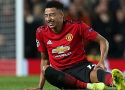 "Thánh" Lingard chấn thương, Man Utd nên vui?