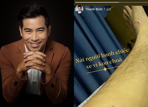 Hậu ly hôn Ngọc Lan, Thanh Bình bị tai nạn nghiêm trọng "nát người banh xe"