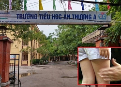 Đề xuất tiêm thuốc đối với 'yêu râu xanh' xâm hại trẻ em