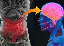 Lợi khuẩn ruột - liệu pháp tiềm năng chữa bệnh Parkinson