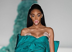 "Người mẫu bạch biến" Winnie Harlow đẹp dịu dàng trên sàn diễn