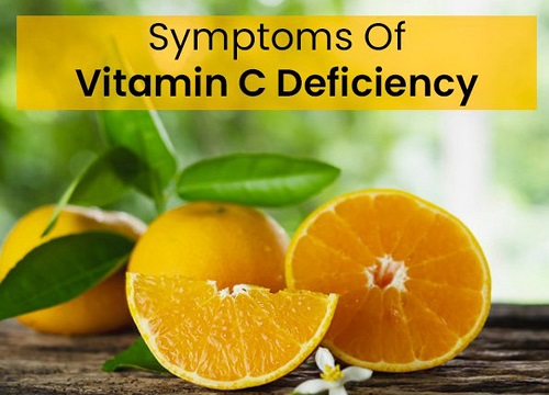 Thiếu vitamin C có thể gây suy giảm miễn dịch