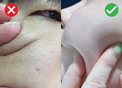 Ấn vào trán và má thế này để kiểm tra xem da có đang bị "quá tải" khi sử dụng acid toner