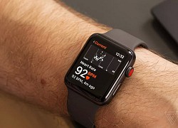 Apple Watch khiến người dùng đi bệnh viện nhầm