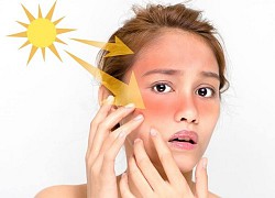 Chăm skincare đêm ngày nhưng lỗ chân lông vẫn to như hố thì chỉ bởi những nguyên nhân này thôi